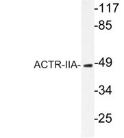 ACTR-IIA Polyclonal Antibody