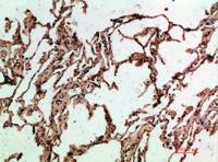 ADI1 Polyclonal Antibody