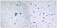 mGluR1 Polyclonal Antibody