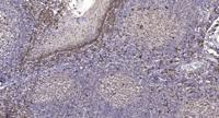 mGluR5 Polyclonal Antibody