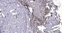 MGST2 Polyclonal Antibody