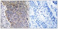 MGST3 Polyclonal Antibody