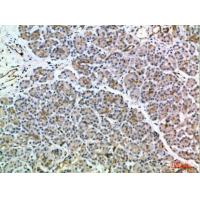 MIA2 Polyclonal Antibody