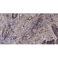 MIA2 Polyclonal Antibody