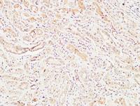 MIB1 Polyclonal Antibody