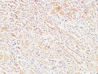 MIB1 Polyclonal Antibody