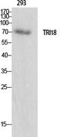 Midline-1 Polyclonal Antibody