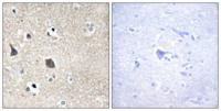 Midline-1 Polyclonal Antibody