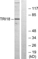 Midline-1 Polyclonal Antibody