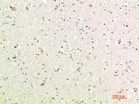 MIG Polyclonal Antibody