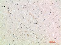 MIG Polyclonal Antibody