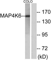 MINK1 Polyclonal Antibody