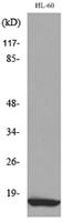 MIP-1β Polyclonal Antibody