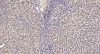 MIP-1β Polyclonal Antibody