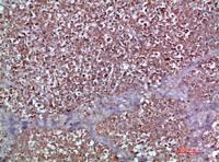 MIP-3α Polyclonal Antibody