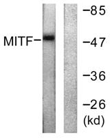 MITF Polyclonal Antibody