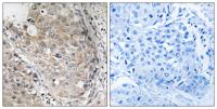 MKP-1/2 Polyclonal Antibody