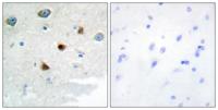 MKP-2 Polyclonal Antibody