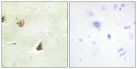 MKP-3 Polyclonal Antibody