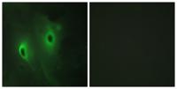 MKP-4 Polyclonal Antibody