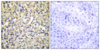 MKP-4 Polyclonal Antibody