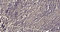 MKP-5 Polyclonal Antibody