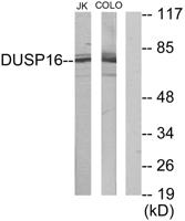 MKP-7 Polyclonal Antibody