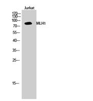 MLH1 Polyclonal Antibody