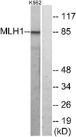 MLH1 Polyclonal Antibody