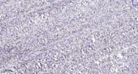 MLH1 Polyclonal Antibody