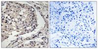 MLK1/2 Polyclonal Antibody