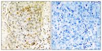 MLK3 Polyclonal Antibody