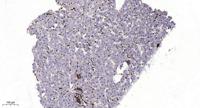 MLKL Polyclonal Antibody