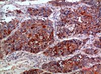 MLL Polyclonal Antibody