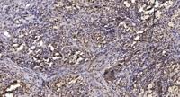 MLTK Polyclonal Antibody