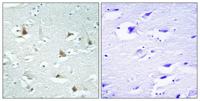 Mlx Polyclonal Antibody