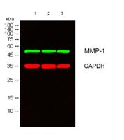 MMP-1 Polyclonal Antibody