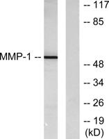 MMP-1 Polyclonal Antibody