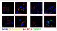 MMP-11 Polyclonal Antibody