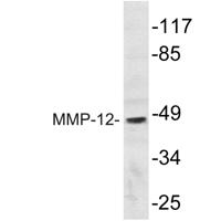 MMP-12 Polyclonal Antibody