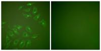 MMP-13 Polyclonal Antibody