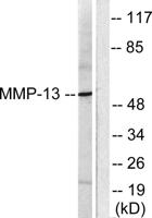 MMP-13 Polyclonal Antibody