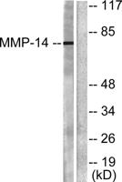 MMP-14 Polyclonal Antibody