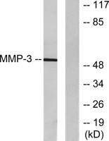 MMP-3 Polyclonal Antibody