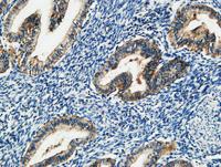 MMP-7 Polyclonal Antibody