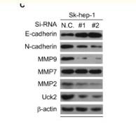 MMP-9 Polyclonal Antibody