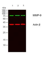 MMP-9 Polyclonal Antibody