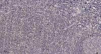 Mnk1 Polyclonal Antibody