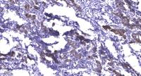 Mnk2 Polyclonal Antibody