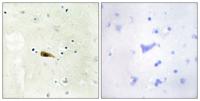 MOF Polyclonal Antibody